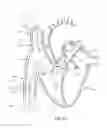 Fig. 46 - Systems and methods for selectively occluding the superior vena cava for treating heart conditions