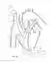 Fig. 47 - Systems and methods for selectively occluding the superior vena cava for treating heart conditions