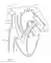 Fig. 48 - Systems and methods for selectively occluding the superior vena cava for treating heart conditions