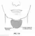 Fig. 131 - Systems, devices and methods for fractional resection, fractional skin grafting, fractional scar reduction and fractional tattoo removal