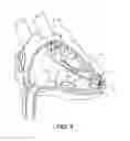 Fig. 02 - Compact implantable medical device and delivery device
