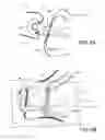Fig. 06 - Device for pacemaker lead placement and methods thereof