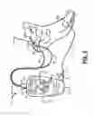 Fig. 02 - System for improving neurostimulation compliance