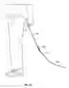 Fig. 09 - Pendulum jump rope