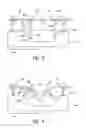 Fig. 03 - Optimized-coverage selective laser ablation systems and methods