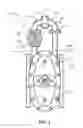 Fig. 02 - Monolithic bypass