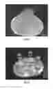 Fig. 08 - Method for three-dimensional fabrication with feed-through carrier