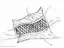 Fig. 01 - METHOD FOR MAKING A CHARGE AIR HOSE