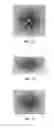Fig. 06 - Article with curved patterns formed of aligned pigment flakes
