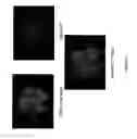 Fig. 06 - S1PR2 ANTAGONISTS AND USES THEREFOR