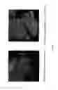 Fig. 08 - S1PR2 ANTAGONISTS AND USES THEREFOR