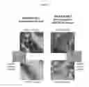 Fig. 02 - Compound that specifically binds to KIR3DL2 for use in the treatment of peripheral T cell lymphoma