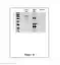 Fig. 06 - GALECTIN IMMUNOTHERAPY