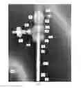 Fig. 02 - Micro alternating tangential flow perfusion filter, micro bioreactor, and methods of use thereof