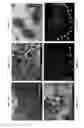 Fig. 04 - COMPOSITION AND METHODS FOR CULTURING RETINAL PROGENITOR CELLS