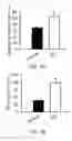 Fig. 02 - Methods and compositions for generating pacemaker cells