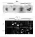 Fig. 02 - Method for producing retinal tissue