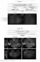 Fig. 06 - Method for producing retinal tissue
