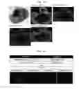 Fig. 09 - Method for producing retinal tissue