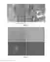 Fig. 08 - STEM CELL COMPOSITIONS AND METHODS OF PRODUCING STEM CELLS FOR THERAPEUTIC APPLICATIONS