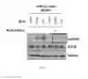 Fig. 07 - Biomarker for predicting sensitivity to EGFR-targeting agent, and use thereof