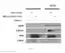 Fig. 13 - Biomarker for predicting sensitivity to EGFR-targeting agent, and use thereof