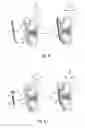 Fig. 08 - RESCUING AND POSITIONING ASSEMBLY