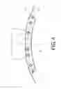 Fig. 05 - Intermittent spigot joint for gas turbine engine casing connection