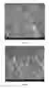 Fig. 06 - Biocompatible polymeric membranes