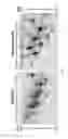 Fig. 02 - Methods and kits for the diagnosis and risk stratification of patients with ischemia