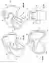 Fig. 08 - Removable elastic hinge for eyeglass frames