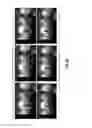 Fig. 22 - BOUNDING BOX SMOOTHING FOR OBJECT TRACKING IN A VIDEO ANALYTICS SYSTEM