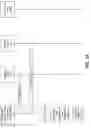 Fig. 07 - Dynamic pattern recognition and data reconciliation
