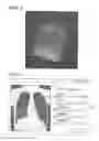 Fig. 04 - MEDICAL IMAGE PROCESSING APPARATUS