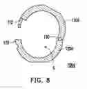 Fig. 06 - SHIELDING CASE