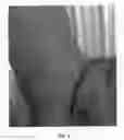 Fig. 04 - Gregg Ash Tree Named 'Libby Davison'