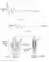Fig. 08 - Fishing rod
