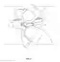 Fig. 07 - Separable bracelet band