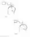 Fig. 04 - Cannula with proximally mounted camera and transparent obturator