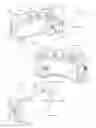 Fig. 02 - Mobile ophthalmic device