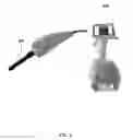 Fig. 03 - Non-invasive detection of skin disease
