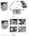 Fig. 08 - Non-invasive detection of skin disease