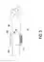 Fig. 05 - Wearable blood pressure measuring device