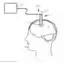 Fig. 01 - Cannula with proximally mounted camera