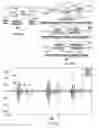 Fig. 06 - SYSTEM AND METHOD OF EXTRACTION OF THE HEART VALVE SIGNALS