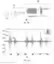 Fig. 07 - SYSTEM AND METHOD OF EXTRACTION OF THE HEART VALVE SIGNALS