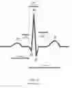 Fig. 04 - Selection of optimal channel for rate determination