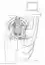 Fig. 02 - Surgical instruments for determining a location of a nerve during a procedure