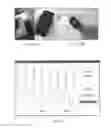 Fig. 08 - System and method for photoplethysmogram (PPG) signal quality assessment