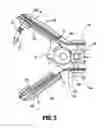 Fig. 03 - Sealing pack assembly for use with endoscopic stitching device